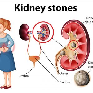 Kidney sservice